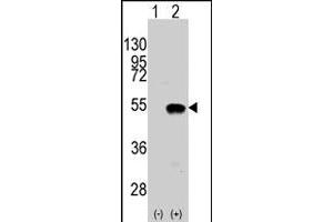 Western blot analysis of SYMD2 (arrow) using rabbit SMYD2 polyclonal antibody . (SMYD2A Antikörper  (N-Term))