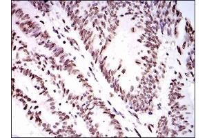 anti-Heterogeneous Nuclear Ribonucleoprotein U (Scaffold Attachment Factor A) (HNRNPU) antibody