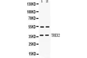 Western blot analysis of TREX2 expression in HELA whole cell lysates ( Lane 1) and MCF-7 whole cell lysates ( Lane 2). (TREX2 Antikörper  (AA 69-279))
