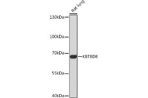 Western blot analysis of extracts of Rat lung, using KBTBD8 Rabbit pAb (ABIN7268076) at 1:1000 dilution. (KBTBD8 Antikörper)