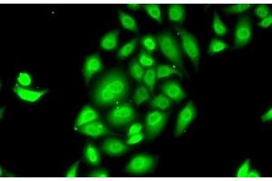 Immunofluorescence analysis of MCF7 cells using SPDEF Polyclonal Antibody (SPDEF/PSE Antikörper)