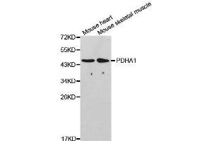 Western Blotting (WB) image for anti-Pyruvate Dehydrogenase (Lipoamide) alpha 1 (PDHA1) (AA 30-390) antibody (ABIN3023697)