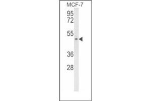 Western blot analysis of SCD5 Antibody (Center) Cat. (SCD5 Antikörper  (Middle Region))