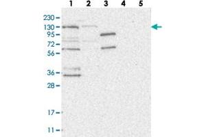 Western blot analysis of Lane 1: RT-4, Lane 2: U-251 MG, Lane 3: Human Plasma, Lane 4: Liver, Lane 5: Tonsil with HEATR6 polyclonal antibody . (HEATR6 Antikörper)