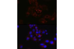 Immunofluorescence analysis of HepG2 cells using ApoB Rabbit pAb (ABIN3015447, ABIN3015448, ABIN5663872 and ABIN6217244) at dilution of 1:50 (40x lens).