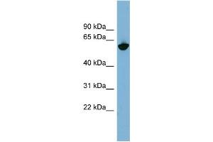 WB Suggested Anti-GPNMB Antibody Titration:  0. (Osteoactivin Antikörper  (N-Term))
