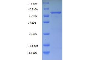 SDS-PAGE (SDS) image for Chemokine (C-C Motif) Ligand 8 (CCL8) (AA 212-553) protein (His-SUMO Tag) (ABIN5711012)