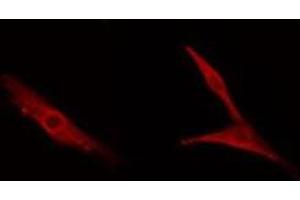 ABIN6278590 staining NIH-3T3 cells by IF/ICC. (MDM1 Antikörper  (Internal Region))