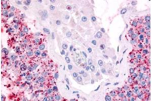 Anti-CDC7 antibody  ABIN1048420 IHC staining of human testis. (CDC7 Antikörper  (Kinase Domain))