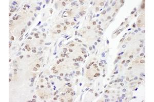 Immunohistochemistry (IHC) image for anti-Achalasia, Adrenocortical Insufficiency, Alacrimia (AAAS) (AA 496-546) antibody (ABIN7455041)