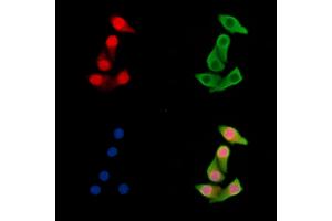 ABIN7095488 and ABIN7099545 staining Hela cells by IF/ICC. (UBXN7 Antikörper)