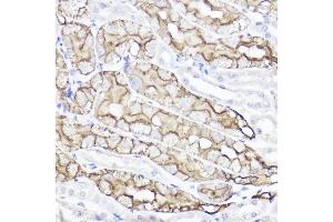 Immunohistochemistry of paraffin-embedded mouse kidney using Aquaporin-1  Rabbit pAb (ABIN7265651) at dilution of 1:100 (40x lens). (Aquaporin 1 Antikörper  (C-Term))