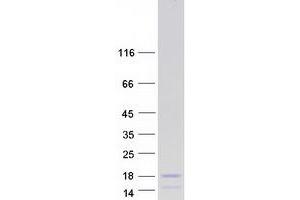 Western Blotting (WB) image for Guanylate Cyclase Activator 2A (Guanylin) (GUCA2A) protein (Myc-DYKDDDDK Tag) (ABIN2722374)