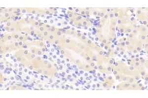 Detection of CTH in Mouse Kidney Tissue using Polyclonal Antibody to Cystathionine (CTH) (Cystathionine (AA 14-224) Antikörper)