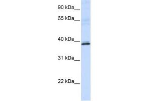 HAO2 antibody used at 1 ug/ml to detect target protein. (Hydroxyacid Oxidase 2 (HAO2) Antikörper)