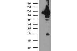 Western Blotting (WB) image for anti-TNF Receptor-Associated Protein 1 (TRAP1) antibody (ABIN1501499)