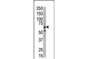 Western blot analysis of anti-DYRKB Pab in mouse kidney tissue lysate (DYRK1B Antikörper  (C-Term))