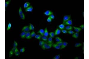 Immunofluorescence staining of Hela cells with ABIN7150052 at 1:166, counter-stained with DAPI. (ADAM29 Antikörper  (AA 701-820))