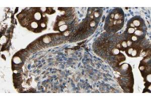 ABIN6269326 at 1/100 staining Mouse intestine tissue by IHC-P. (GRIN1/NMDAR1 Antikörper  (C-Term))