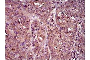 Immunohistochemistry (IHC) image for anti-Interleukin 3 Receptor, alpha (IL3RA) (AA 200-305) antibody (ABIN1845738) (IL3RA Antikörper  (AA 200-305))