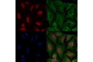 ABIN7093646 and ABIN7097672 staining  cells by IF/ICC. (HBP1 Antikörper)