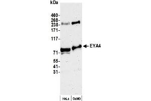 anti-Eyes Absent Homolog 4 (EYA4) (AA 1-50) antibody