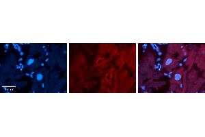 Rabbit Anti-SF1 Antibody   Formalin Fixed Paraffin Embedded Tissue: Human heart Tissue Observed Staining: Nucleus Primary Antibody Concentration: 1:100 Other Working Concentrations: N/A Secondary Antibody: Donkey anti-Rabbit-Cy3 Secondary Antibody Concentration: 1:200 Magnification: 20X Exposure Time: 0.