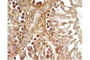 Rat testis tissue was stained by Rabbit Anti-Desnutrin (465-486) (Mouse) Serum (PNPLA2 Antikörper  (AA 465-486))