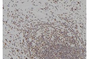 ABIN6278999 at 1/100 staining Human gastric tissue by IHC-P.