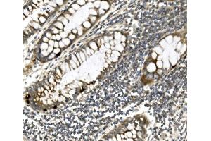 IHC analysis of PVRL1/NECTIN1 using anti-PVRL1/NECTIN1 antibody (ABIN7601298).
