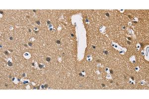 Immunohistochemistry of paraffin-embedded Human brain using PPP3CA Polyclonal Antibody at dilution of 1:40 (PPP3CA Antikörper)