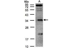 WB Image Sample(30 μg of whole cell lysate) A:H1299 12% SDS PAGE antibody diluted at 1:500 (FN3KRP Antikörper)