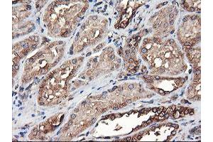 Immunohistochemical staining of paraffin-embedded Human Kidney tissue using anti-TUBAL3 mouse monoclonal antibody. (TUBAL3 Antikörper  (AA 150-446))