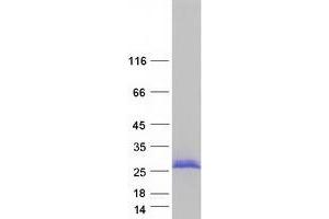 Western Blotting (WB) image for Neurocalcin delta (NCALD) (Transcript Variant 6) protein (Myc-DYKDDDDK Tag) (ABIN2726870)