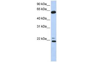 Western Blotting (WB) image for anti-Chaperonin Containing TCP1, Subunit 5 (Epsilon) (CCT5) antibody (ABIN2459816) (CCT5 Antikörper)
