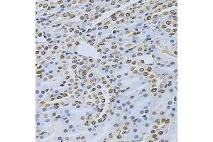 Immunohistochemistry of paraffin-embedded rat kidney using ILK Antibody. (ILK Antikörper  (AA 1-260))