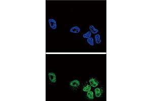 Confocal immunofluorescent analysis of PLA2G4A Antibody with NCI-H460 cell followed by Alexa Fluor488-conjugated goat anti-rabbit lgG (green). (PLA2G4A Antikörper  (AA 513-541))