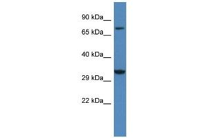 WB Suggested Anti-Cacng2 Antibody   Titration: 1. (Stargazin Antikörper  (Middle Region))