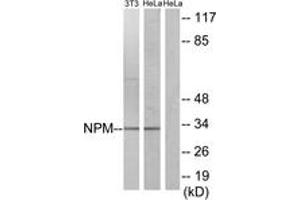 Western blot analysis of extracts from HeLa/NIH-3T3 cells, using NPM (Ab-234) Antibody. (NPM1 Antikörper  (AA 201-250))