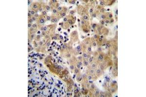 Immunohistochemistry analysis in formalin fixed and paraffin embedded human liver tissue reacted with LIN7C Antibdy (C-term) followed by peroxidase conjugation of the secondary antibody and DAB staining. (LIN7C Antikörper  (C-Term))