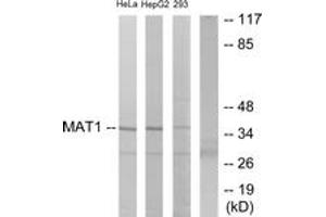 Western blot analysis of extracts from HeLa/HepG2/293 cells, using MAT1 Antibody.