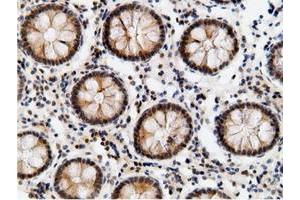 Image no. 4 for anti-EPM2A (Laforin) Interacting Protein 1 (EPM2AIP1) antibody (ABIN1498047) (EPM2AIP1 Antikörper)