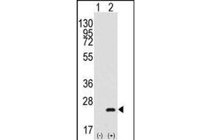 Western blot analysis of BarX1(arrow) using rabbit polyclonal BarX1 Antibody (C-term) (R). (BARX1 Antikörper  (AA 119-148))