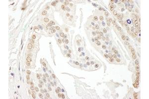 anti-Polymerase (RNA) III (DNA Directed) Polypeptide D, 44kDa (POLR3D) (AA 175-225) antibody