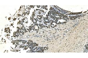 IHC analysis of LSM7 using anti-LSM7 antibody (ABIN7598937).