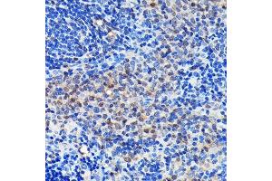 Immunohistochemistry (IHC) image for anti-Growth Factor Receptor-Bound Protein 2 (GRB2) antibody (ABIN7267518)