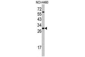 Western blot analysis of SFRS5 antibody (Center Y85) in NCI-H460 cell line lysates (35ug/lane). (SRSF5 Antikörper  (Middle Region))