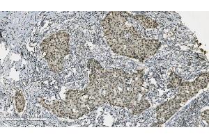 IHC analysis of PARP using anti-PARP antibody (ABIN7602278). (PARP1 Antikörper  (AA 670-858))