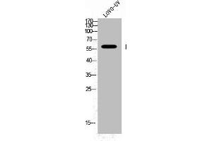 Western Blot analysis of LOVO+UV cells using Phospho-Fyn (Y530) Polyclonal Antibody (FYN Antikörper  (pTyr530))