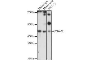 Western blot analysis of extracts of various cell lines, using KCN antibody (ABIN7269481) at 1:1000 dilution. (KCNAB2 Antikörper  (AA 1-40))